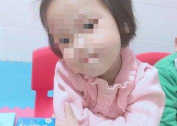 Người nhà bé gái 3 tuổi qua đời vì bị đóng đinh vào đầu quyết định hỏa táng cho bé