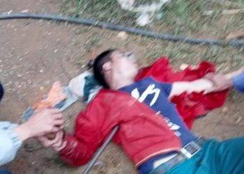 Rơi từ mái nhà xuống, người đàn ông nguy kịch khi bị xà beng đâm xuyên ngực