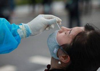 Tiếp xúc F0 sau bao lâu thì cần test COVID-19; F0 điều trị tại nhà nên test bao nhiêu lần?