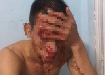 Dàn cảnh bị bắt cóc để tống tiền gia đình