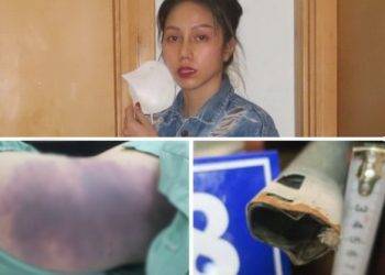 Tình tiết mới phẫn nộ vụ "mẹ kế" bạo hành bé 8 tuổi: Bắt quỳ gối, nhốt trong chuồng chó