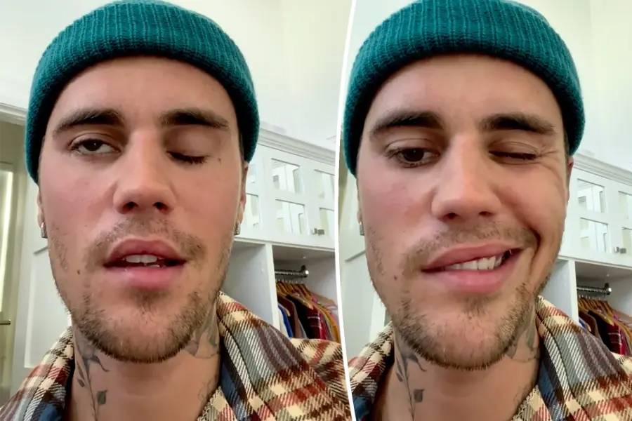 Justin Bieber bị liệt nửa mặt do nhiễm virus hiếm