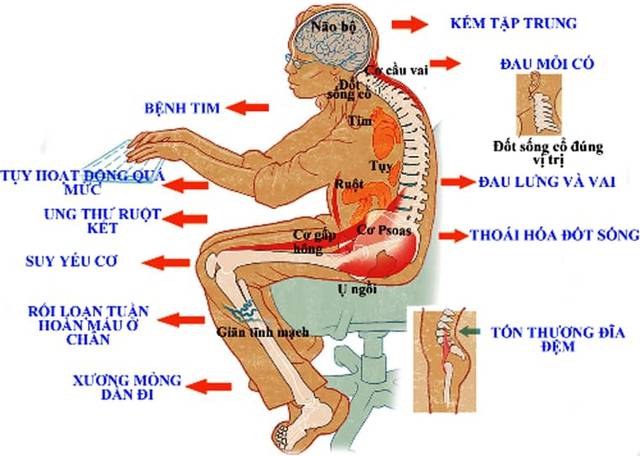 Thói quen đáng sợ rút ngắn tuổi thọ của dân văn phòng, chuyên gia khuyến cáo chỉ cần kết hợp động tác này sẽ hạn chế rủi ro