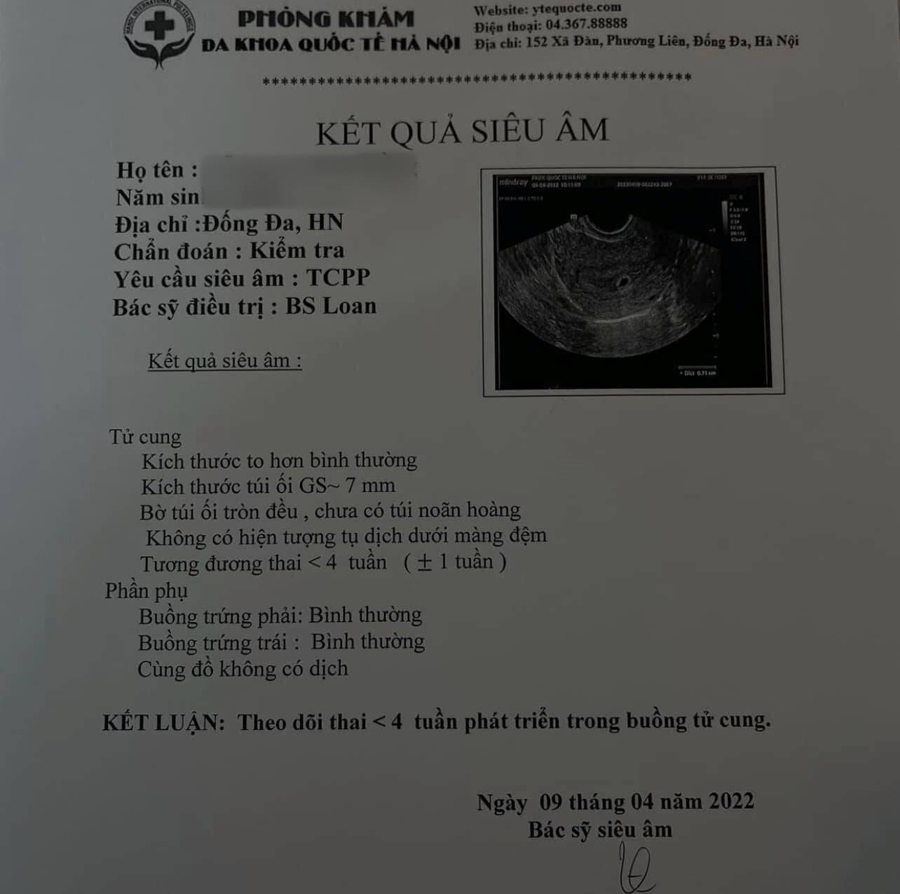 Toàn cảnh vụ cô gái bóc phốt bạn trai Công an rũ bỏ trách nhiệm: Yêu cầu chu cấp với số tiền khủng?