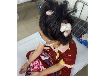 Vụ thiếu nữ 16 tuổi bị cha dượng dùng tuýp sắt đánh bất tỉnh: Diễn biến mới nhất