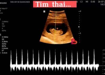 Bác sĩ phụ sản kể chuyện thai phụ 2 lần bỏ con khiến lòng người nhức nhối: Xin đừng từ chối một món quà!