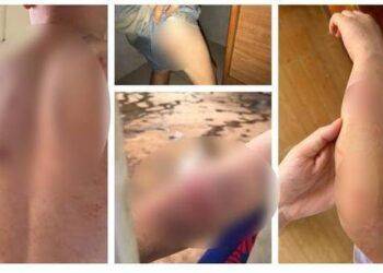 Bị tố đánh con trai 9 tuổi dã man, người bố nói gì?