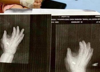 Cháu bé 4 tuổi bị bắn tại quán karaoke ở Thanh Hóa