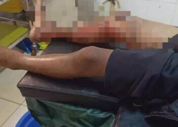 Cháu bé 8 tuổi bị tẩm xăng đốt vì không chịu đi trộm cắp