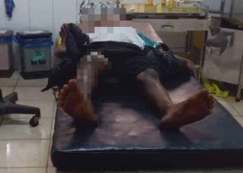 Công an thông tin chính thức vụ bé trai bị đốt