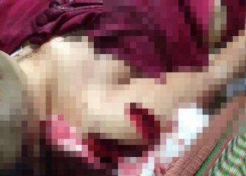 Người vợ bị chồng chém 8 nhát dao đã qua cơn nguy kịch