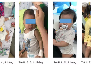 Nhiều trẻ dưới 1 tuổi nguy kịch vì sốt xuất huyết do nhầm với bệnh khác