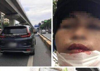 tai xe xe om bi lai xe cr v dam gay rang vi khong cho vuot Lái xe CR-V đấm gãy răng tài xế xe ôm vì 'không cho vượt' Tài xế xe ôm bị lái xe CR-V đấm gãy răng vì... không cho vượt