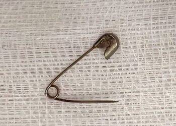 Bé 6 tháng tuổi suýt bị kim băng đâm thủng dạ dày