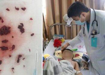 Bé trai 4 tuổi bị đột quỵ sau khi mắc COVID-19