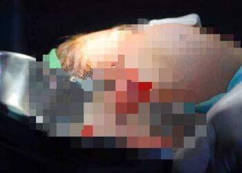 Cứu cô gái gặp nạn vì muốn làm mặt "trẻ như baby"