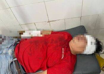 loi khai nhan vien quan karaoke chem gan lia tay khach o tp thu duc Nhân viên quán karaoke cầm dao chém gần lìa cánh tay khách ở TP Thủ Đức Lời khai nhân viên quán karaoke chém gần lìa tay khách ở TP Thủ Đức