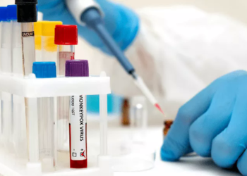 Thêm nước Đông Nam Á có đậu mùa khỉ, WHO nghi Ebola tái xuất