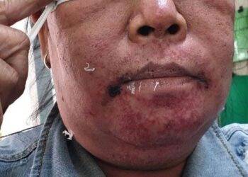 'Thuốc 7 màu' và những tác hại khi sử dụng không đúng cách