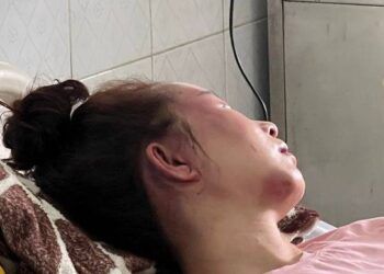 Vụ cán bộ QLTT đánh cô gái dã man: Nạn nhân phải phẫu thuật và theo dõi thêm phần não