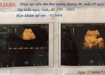 Bảo vệ 70 tuổi xâm hại bé lớp 6 mang thai, xử thế nào?