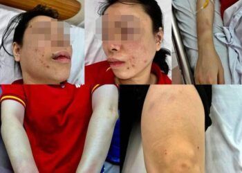 Người phụ nữ ở Hà Nội tố bị chồng cũ "bắt cóc", đánh đập dã man