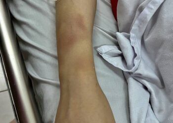 nguoi phu nu to bi chong cu bat coc danh dap da man hoi lhpn quan bac t Hội LHPN quận Bắc Từ Liêm đề nghị xử lý nghiêm vụ người phụ nữ bị chồng cũ 'bắt cóc' hành hung dã man Người phụ nữ tố bị chồng cũ 'bắt cóc' đánh đập dã man: Hội LHPN quận Bắc Từ Liêm đề nghị xử lý nghiêm