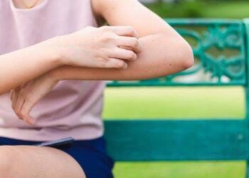 Tại sao muỗi đốt lại gây ngứa cho da?