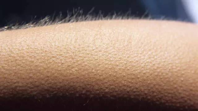 Vì sao cơ thể người “nổi da gà” khi lạnh?