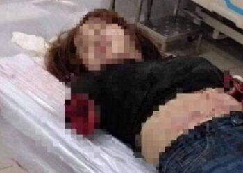 Vụ chém đứt lìa 2 tay vợ: Người nhà yêu cầu bác sĩ giữ kín mọi thông tin