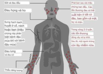 5 lý do để không nên quá hoang mang về bệnh đậu mùa khỉ