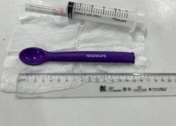 Cô gái 20 tuổi nuốt luôn thìa nhựa 15cm vào bụng