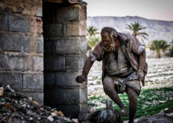 Giới khoa học 'mổ sẻ' tìm câu trả lời: Vì sao 'người bẩn nhất thế giới' lại qua đời sau khi tắm lần đầu tiên?