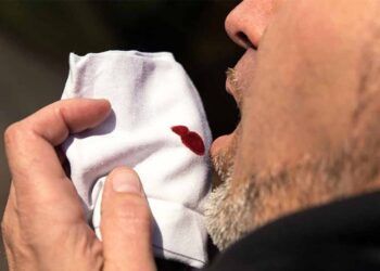 Ho ra máu là biểu hiện của bệnh gì?