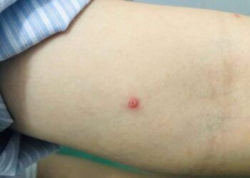 Khuyến cáo phòng ngừa lây nhiễm đậu mùa khỉ ở động vật, đặc biệt là chó nhà