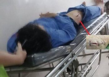 Một cán bộ Cục Thuế Ninh Bình bị kẻ bịt mặt đâm thương tích