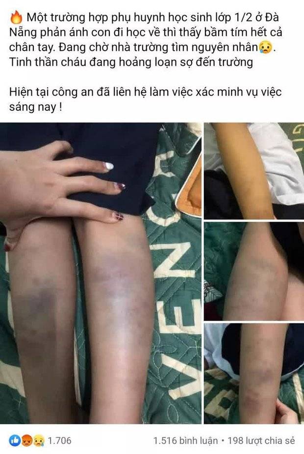 Một học sinh ở Đà Nẵng hoảng loạn khi từ trường về nhà