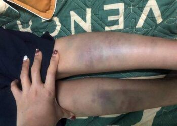 Một học sinh ở Đà Nẵng hoảng loạn khi từ trường về nhà