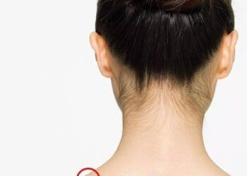 Người sở hữu nốt ruồi ở vị trí này trên lưng có số phú quý