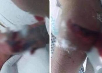 Thái Bình: Chém trọng thương bố, cậu bạn gái trong ''bữa cơm ra mắt"