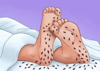 10 dấu hiệu từ cơ thể "tố cáo" bạn đang bị thiếu khoáng chất, vitamin hoặc mắc bệnh nghiêm trọng