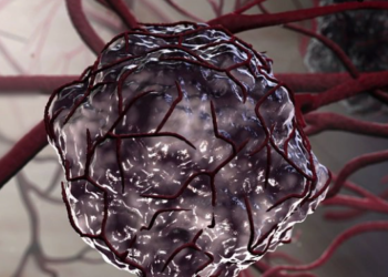 4 cam giac ky la tren co the la dau hieu ban dang mac ung thu ma khong biet 4 cảm giác 'kỳ lạ' trên cơ thể cảnh báo bạn đang mắc ung thư 4 cảm giác 'kỳ lạ' trên cơ thể là dấu hiệu bạn đang mắc ung thư mà không biết