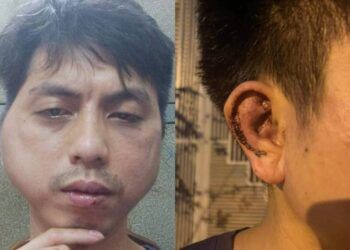 Chủ quán lẩu đánh nhân viên xin nghỉ việc: Khởi tố vụ án