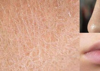 Mùa lạnh hanh khô nên ăn những thực phẩm này bởi giữ ẩm cực tốt