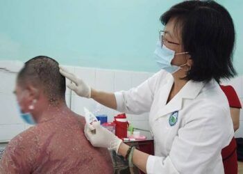 Nhập viện vì dùng thuốc chữa vảy nến trên mạng