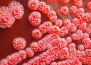 nhung bieu hien lam sang thuong gap cua benh whitmore Dấu hiệu thường gặp khi mắc bệnh Whitmore Những biểu hiện lâm sàng thường gặp của bệnh Whitmore