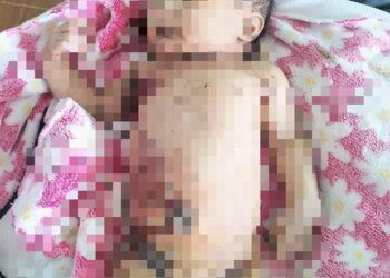 Quảng Nam: Xót xa bé sơ sinh bị bỏ rơi giữa rừng, giòi bám đầy người