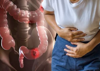 Bệnh nhân ung thư ruột giai đoạn cuối sẽ trải qua 6 triệu chứng này