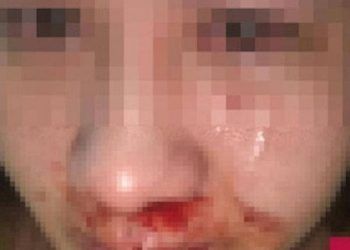 Cán bộ công an ở Hà Nội bị tố hành hung vợ con