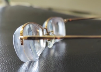 di kham moi phat hien can toi 30 do nguoi phu nu phai cat bo doi mat Phẫu thuật cắt bỏ đôi mắt vì cận thị quá nặng Đi khám mới phát hiện cận tới 30 độ, người phụ nữ phải cắt bỏ đôi mắt